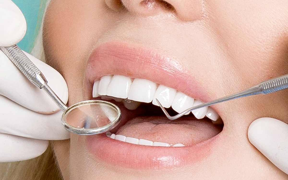 Vosstanovlenie zubov